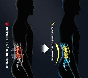 Бандаж Поясничный ANRI.E. BS-001 с Рёбрами Жёсткости (Синий)